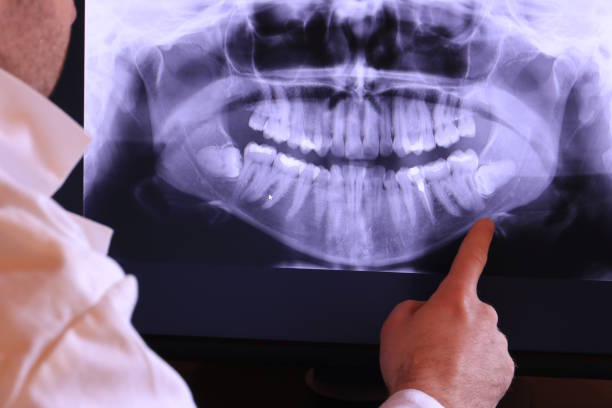Best Emergency Broken Tooth Repair in Glen Cove, NY